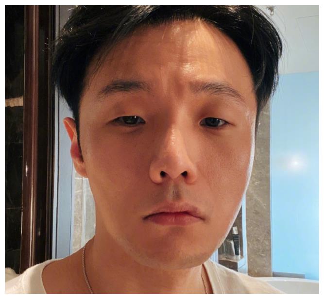 小眼睛李荣浩变双眼皮是啥样?看到最后效果,演反派都不用化妆了