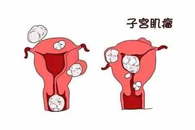 这种表现是临床常见的表现之一,而女性月经量长时间增多,就会