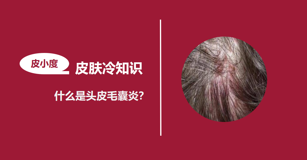 葡萄球菌|毛囊炎|疙瘩_新浪新闻
