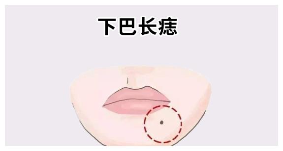 下巴长痣在相学当中,若是在下巴处的位置长有吉痣,下巴长得饱满明亮
