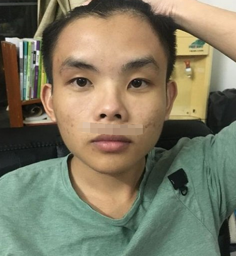 面容苍白无力,眼睛无神,要注意自身的身体健康