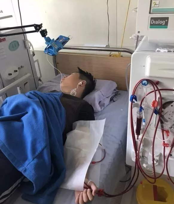 换肾费用是多少