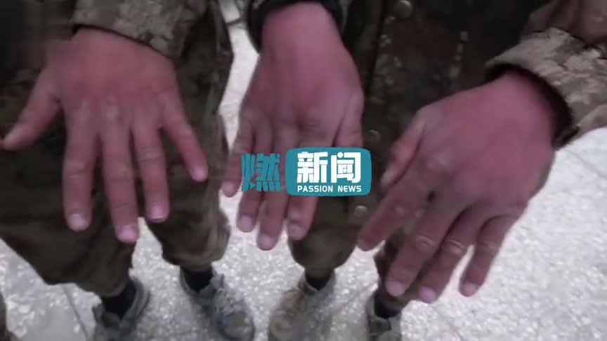 泪目!近距离看边防战士布满冻疮伤痕的手网友直呼难受心疼!