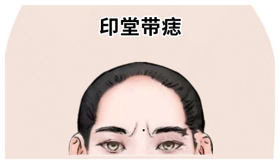 婆娑眉所谓的婆娑眉,就是指他们的眉毛根根下垂,比较稀疏,则往往这样
