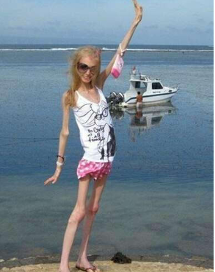 跳水运动员为什么那么瘦 体操运动员容易发胖原因