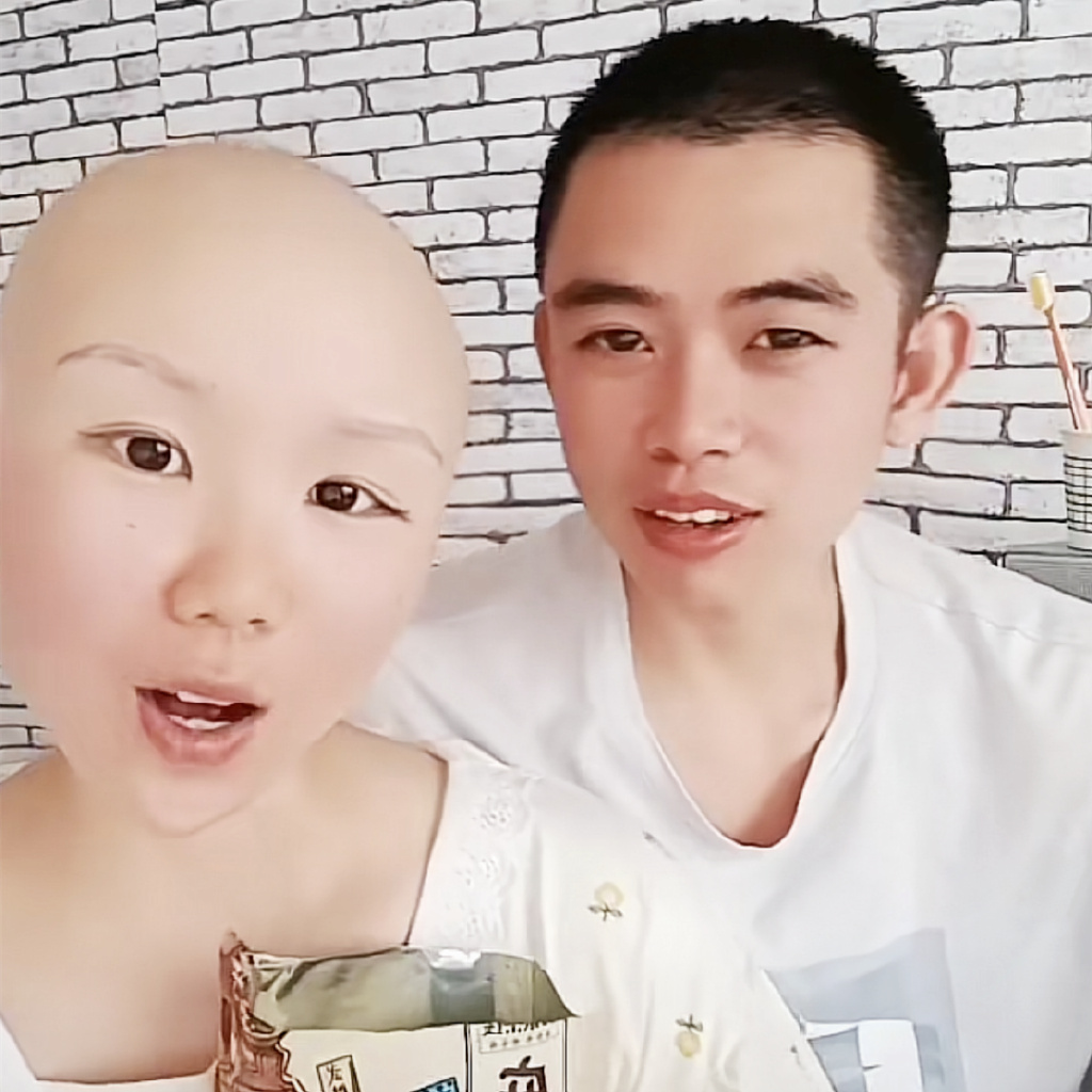 28岁中国青年舞蹈家 抗癌女孩苏日曼 因胃癌去世 - 脉脉