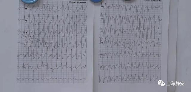 一字之差，两种完全不同治疗方案！心脏病变细节就藏在这张图上…(图3)