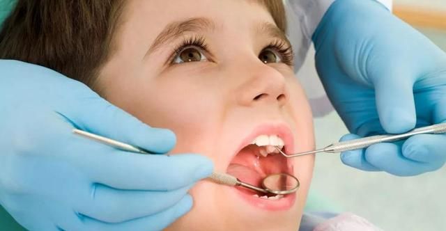 预防龋齿,可并不是每个儿童都要做窝沟封闭,这需要医生根据儿童的实际