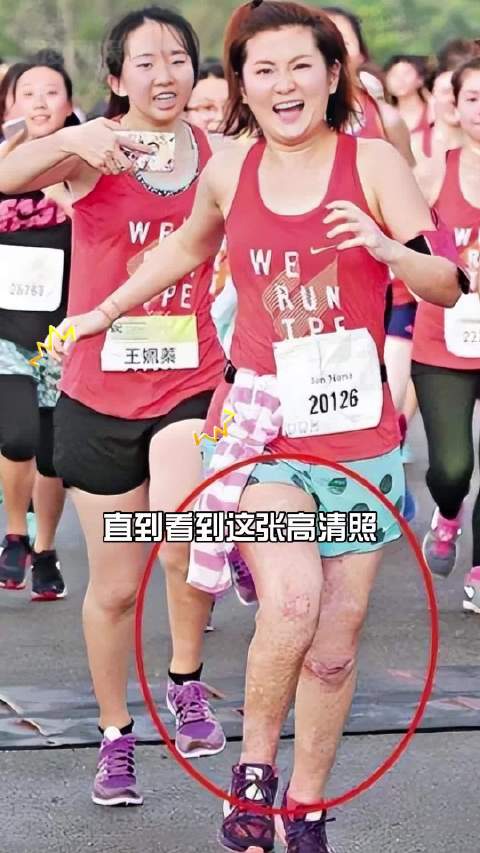 为何俞灏明夏天总是“全裹”出镜？