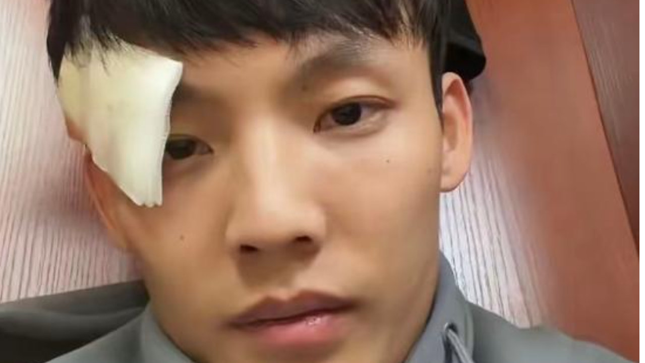 徐杰最新伤情报告！眉骨缝了数针，社媒发声彰显担当，杜锋祈祷