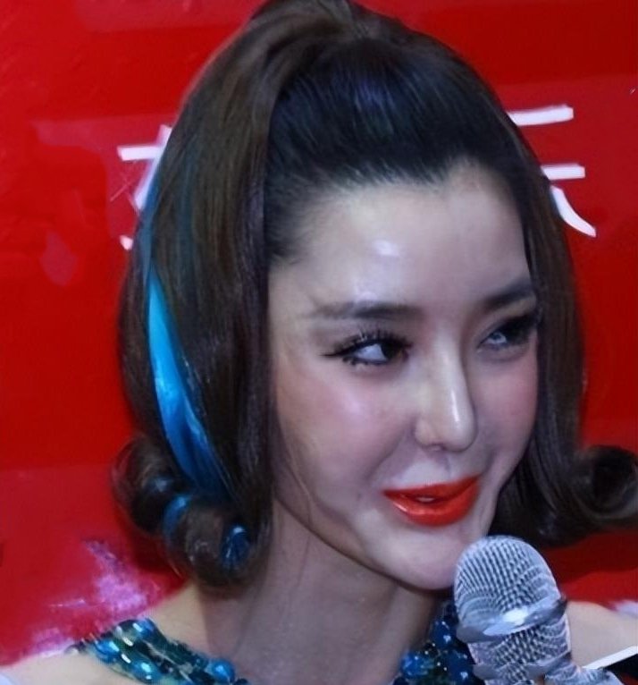 脸没恢复就别接戏了,“馒头脸蛋”演啥都拉胯,这些演员不羞吗?休闲区蓝鸢梦想 - Www.slyday.coM 脸没恢复就别接戏了,“馒头脸蛋”演啥都拉胯,这些演员不羞吗?休闲区蓝鸢梦想 - Www.slyday.coM