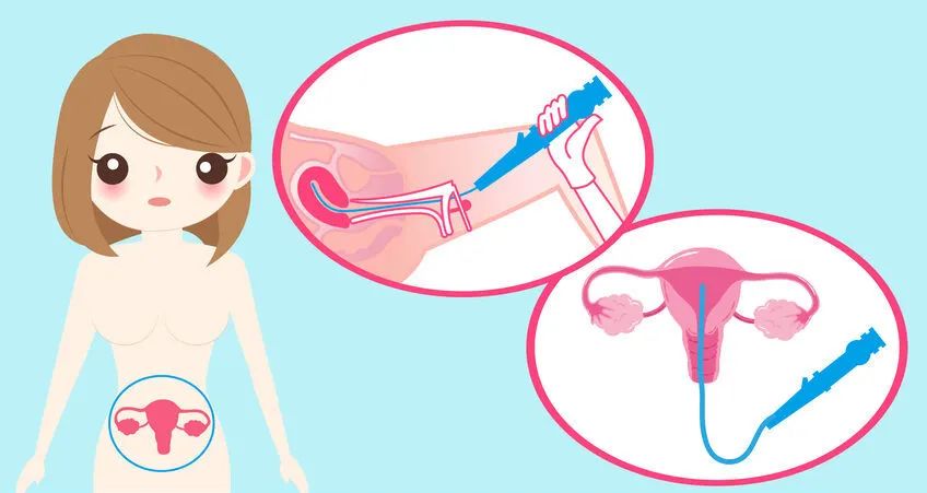 身体查出的各种“息肉”离癌到底有多远?要不要切有套判断标准!休闲区蓝鸢梦想 - Www.slyday.coM 身体查出的各种“息肉”离癌到底有多远?要不要切有套判断标准!休闲区蓝鸢梦想 - Www.slyday.coM