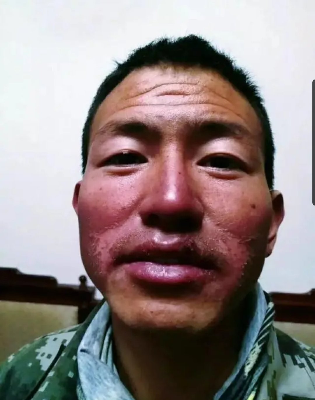 这些满脸沧桑被晒掉皮的人是我们驻守在青藏高原边防线上的战士