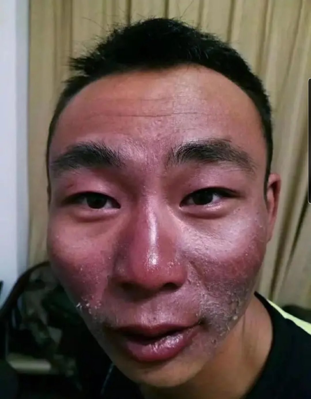 这些满脸沧桑被晒掉皮的人是我们驻守在青藏高原边防线上的战士