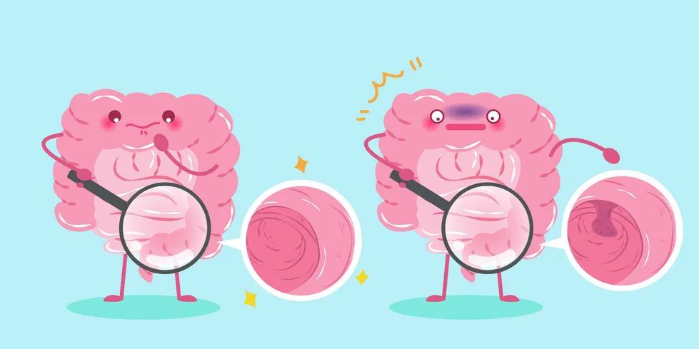 身体查出的各种“息肉”离癌到底有多远?要不要切有套判断标准!休闲区蓝鸢梦想 - Www.slyday.coM 身体查出的各种“息肉”离癌到底有多远?要不要切有套判断标准!休闲区蓝鸢梦想 - Www.slyday.coM