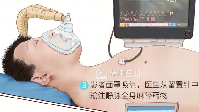 特殊服务怎么问才不尴尬？这5个沟通技巧让你避免社死现场