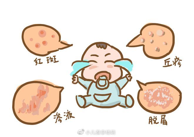公寓房40年后拆迁有赔偿吗（公寓40年到了拆了怎么办）小儿推拿杨晓：春季婴幼儿湿疹高发，宝宝为什么长湿疹？怎样预防，
