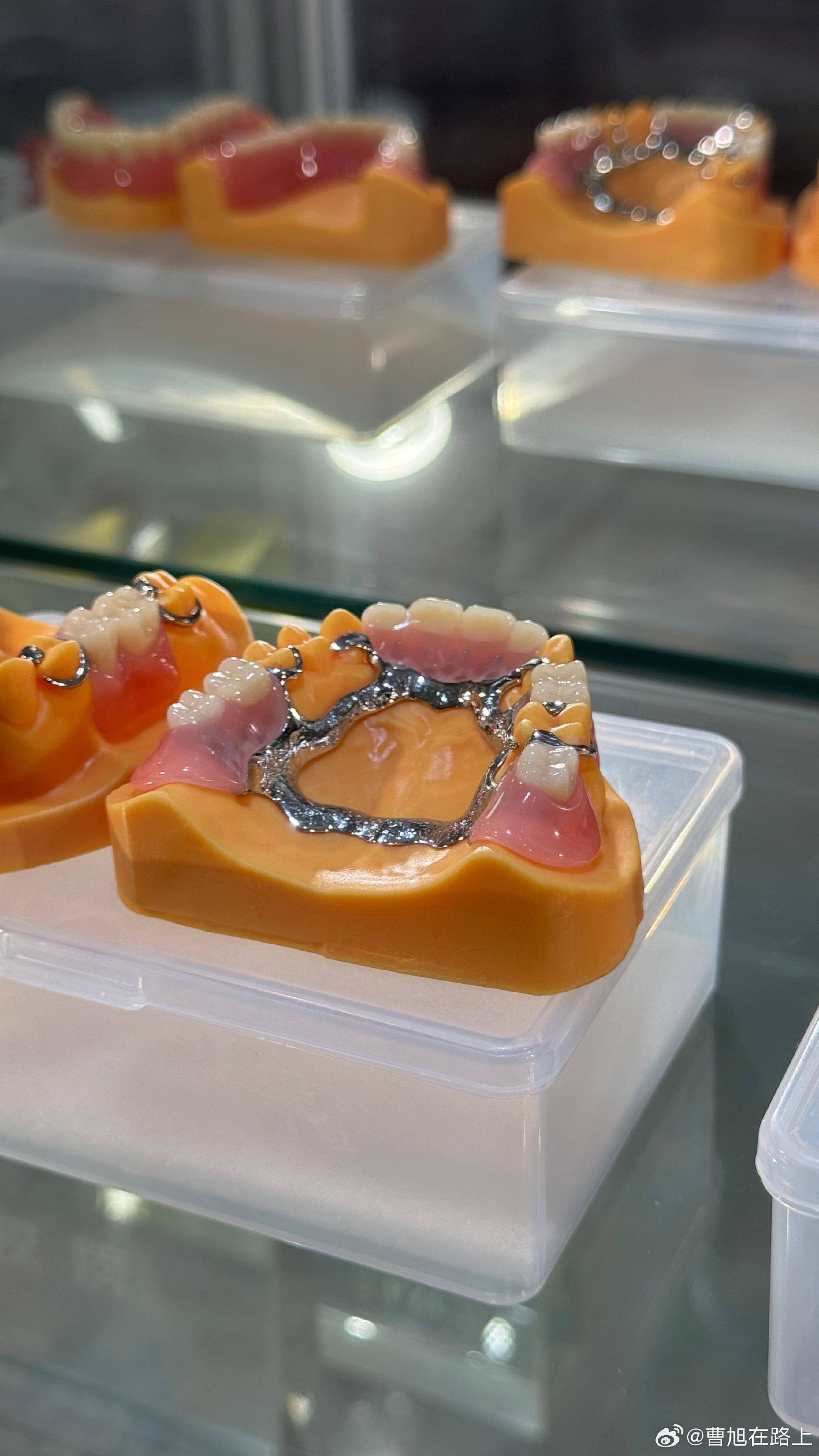 车主进站保养清洗防沙隔尘网，坦言看牙医会怂