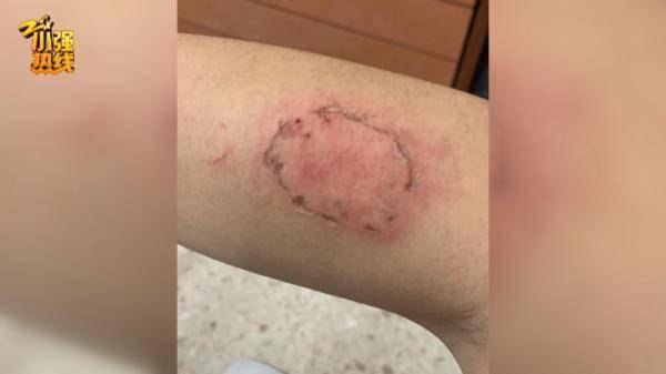 开车出门,突然被陌生男子咬了十几口!浙江一男子婚都没订成,真相竟然是…休闲区蓝鸢梦想 - Www.slyday.coM 开车出门,突然被陌生男子咬了十几口!浙江一男子婚都没订成,真相竟然是…休闲区蓝鸢梦想 - Www.slyday.coM