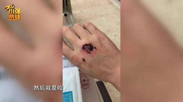 开车出门,突然被陌生男子咬了十几口!浙江一男子婚都没订成,真相竟然是…休闲区蓝鸢梦想 - Www.slyday.coM 开车出门,突然被陌生男子咬了十几口!浙江一男子婚都没订成,真相竟然是…休闲区蓝鸢梦想 - Www.slyday.coM