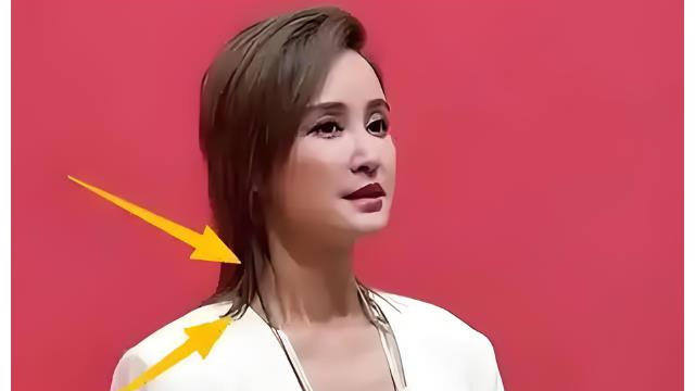 44岁张歆艺近照曝光！瘦成排骨胸、脸僵嘴歪，网友直呼认不出