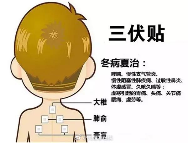 小儿推拿杨晓:冬病夏治三伏贴的原理、功效、适应症及贴敷禁忌!6 小儿推拿杨晓:冬病夏治三伏贴的原理、功效、适应症及贴敷禁忌!