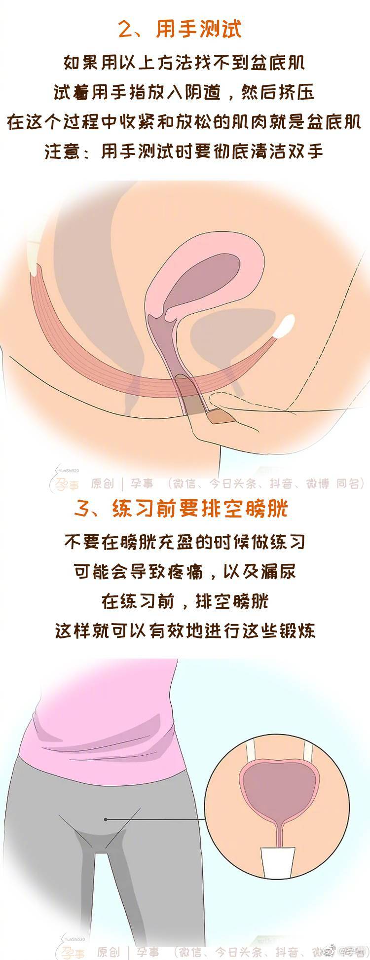 凯格尔运动的全方位指南来了正确练习助力分娩预防漏尿