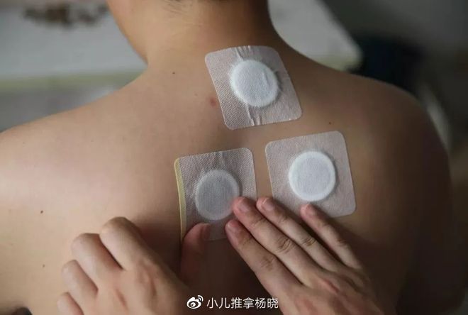小儿推拿杨晓:冬病夏治三伏贴的原理、功效、适应症及贴敷禁忌!5 小儿推拿杨晓:冬病夏治三伏贴的原理、功效、适应症及贴敷禁忌!