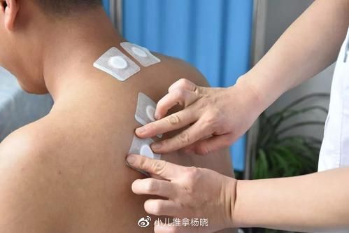 小儿推拿杨晓:冬病夏治三伏贴的原理、功效、适应症及贴敷禁忌!4 小儿推拿杨晓:冬病夏治三伏贴的原理、功效、适应症及贴敷禁忌!