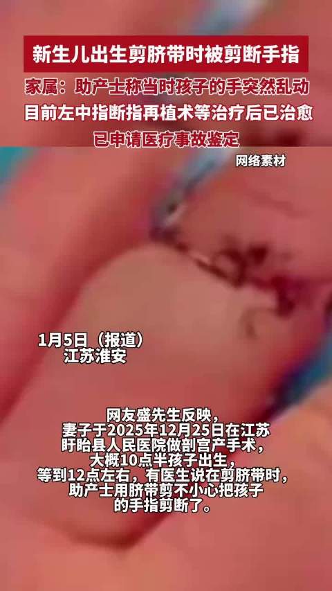 新生儿出生剪脐带时被剪断手指，家属：助产士称因为当时孩子的手突然乱动