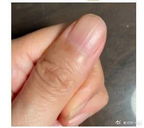 千万不要错过春天这个水果，补血明目消火气，还乌发养颜，不寒也不热休闲区蓝鸢梦想 - Www.slyday.coM