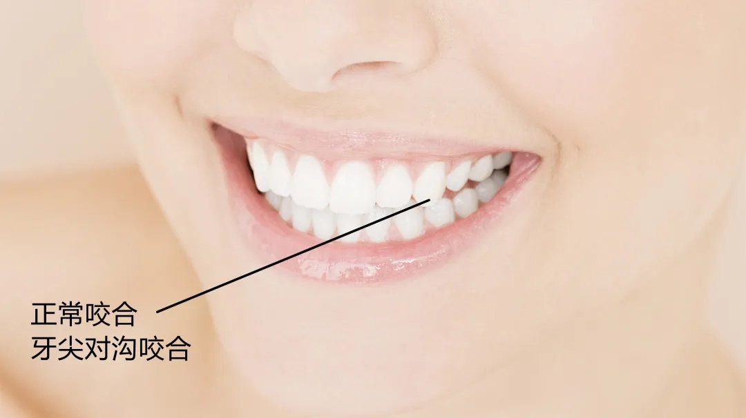 "咬合"可通俗理解成:正常状态下嘴巴闭合时,上,下牙列的相互位置关系