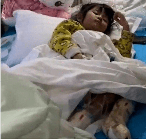 贵州4岁女孩被虐待 双脚烫伤严重需截肢 爷爷发声后妈很凶休闲区蓝鸢梦想 - Www.slyday.coM 贵州4岁女孩被虐待 双脚烫伤严重需截肢 爷爷发声后妈很凶休闲区蓝鸢梦想 - Www.slyday.coM