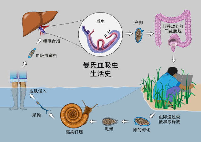 可在人体寄生三十四年日产卵1000多颗新中国如何清除血吸虫