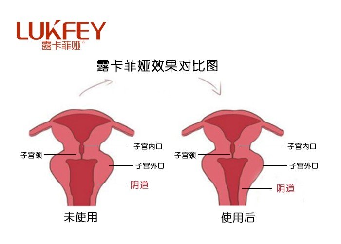 女性私护产品排行榜_解决女性私密健康危机,高端女性私护品牌私慕思震撼上市