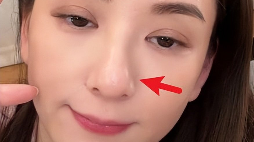 宝宝歪脖子的原因