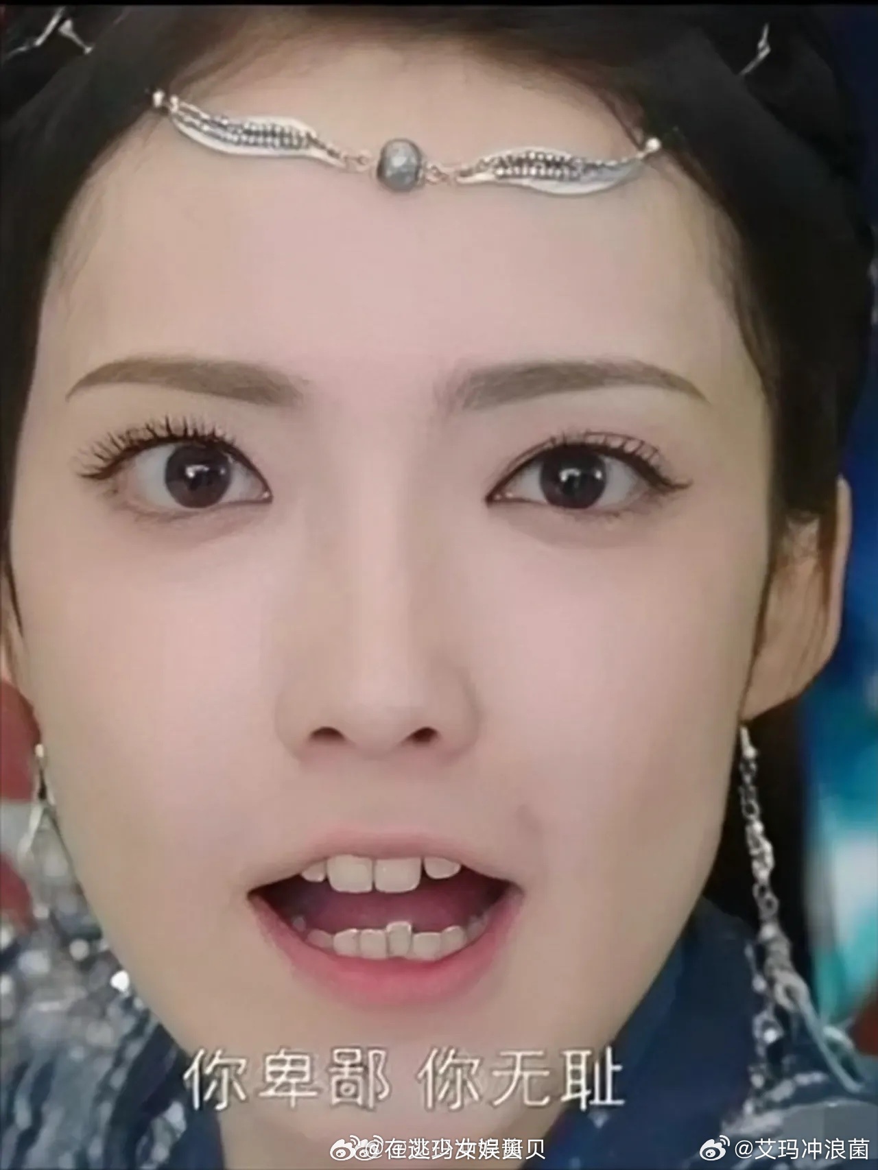 女明星整牙现象引热议