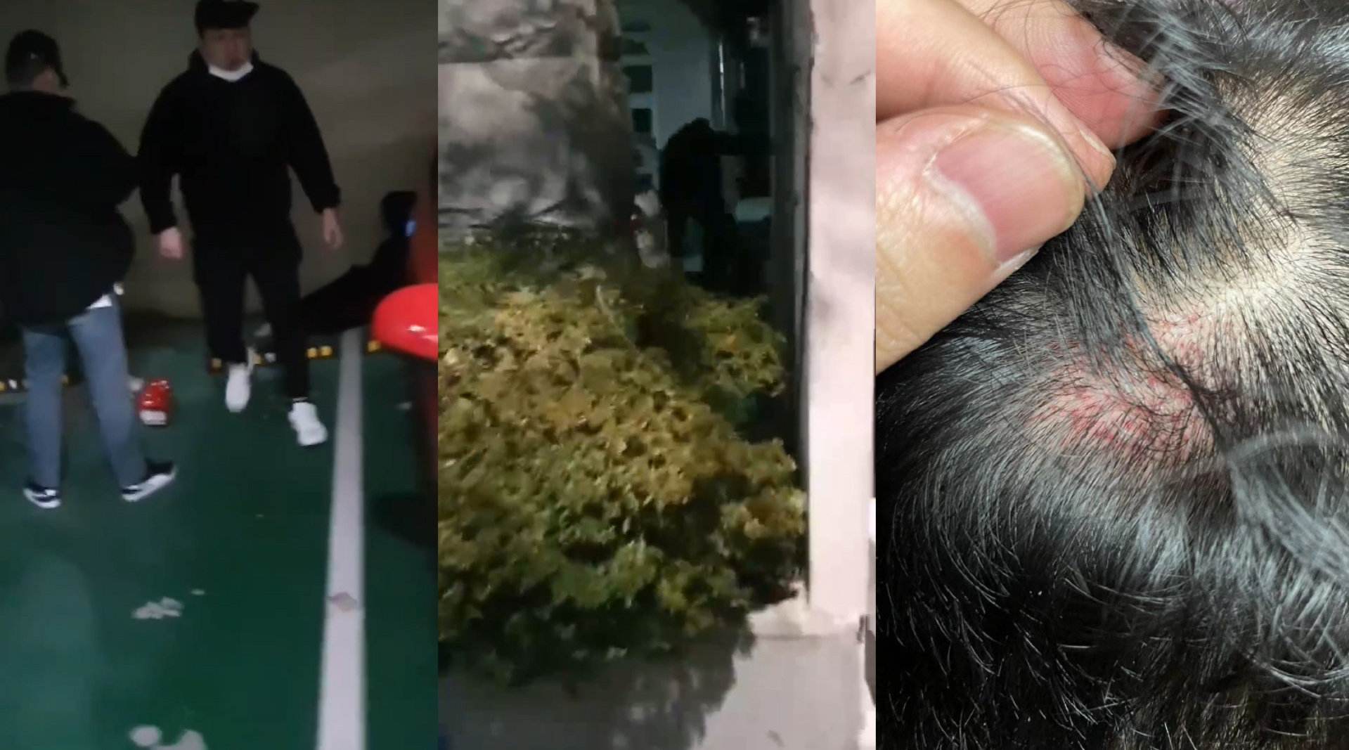 用脚踹脑袋！<a href=