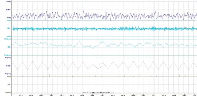 什么?这群铁路人的工作竟然是做“心电图”?休闲区蓝鸢梦想 - Www.slyday.coM 什么?这群铁路人的工作竟然是做“心电图”?休闲区蓝鸢梦想 - Www.slyday.coM