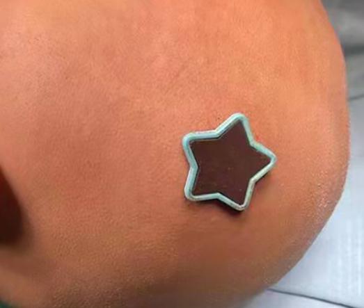 注意!3岁女童打闹中跌落磁力钉扎进颅内,撞碎颅骨刺破脑膜休闲区蓝鸢梦想 - Www.slyday.coM 注意!3岁女童打闹中跌落磁力钉扎进颅内,撞碎颅骨刺破脑膜休闲区蓝鸢梦想 - Www.slyday.coM