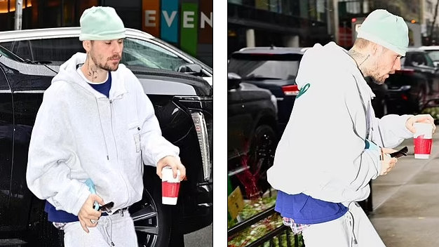 贾斯汀·比伯邋遢外出，“像行尸走肉”，被多位医生证实健康受损