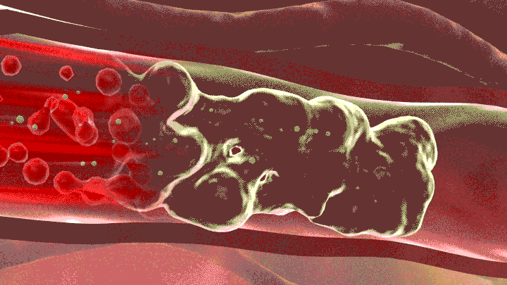 原材料双标？只对中国、俄罗斯涨价？我劝你少吃<a href=