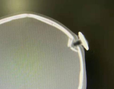 注意!3岁女童打闹中跌落磁力钉扎进颅内,撞碎颅骨刺破脑膜休闲区蓝鸢梦想 - Www.slyday.coM 注意!3岁女童打闹中跌落磁力钉扎进颅内,撞碎颅骨刺破脑膜休闲区蓝鸢梦想 - Www.slyday.coM