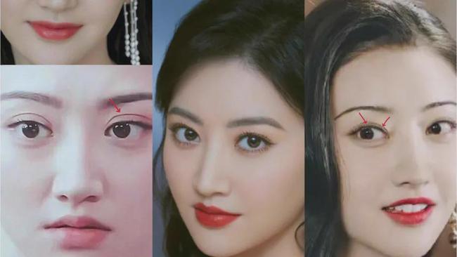 为什么景甜的悲伤蛙双眼皮可以修复成富贵花,温婉却像