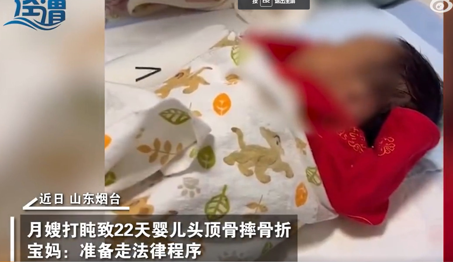 月嫂拍嗝时打盹致22天婴儿头顶骨骨折