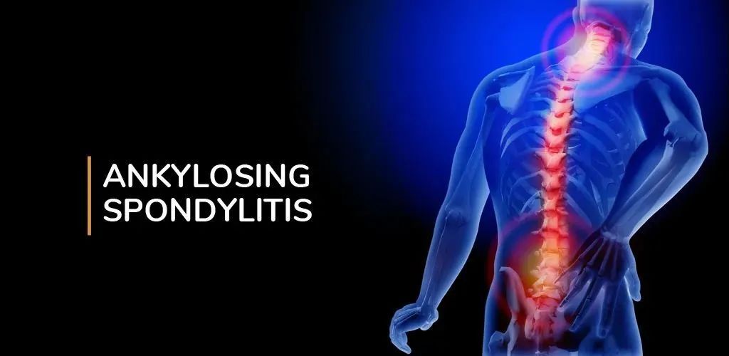 李宇春自曝患上不治之症,“不死的癌症”有多可怕休闲区蓝鸢梦想 - Www.slyday.coM 李宇春自曝患上不治之症,“不死的癌症”有多可怕休闲区蓝鸢梦想 - Www.slyday.coM