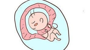 脐带绕颈的3个解决方法