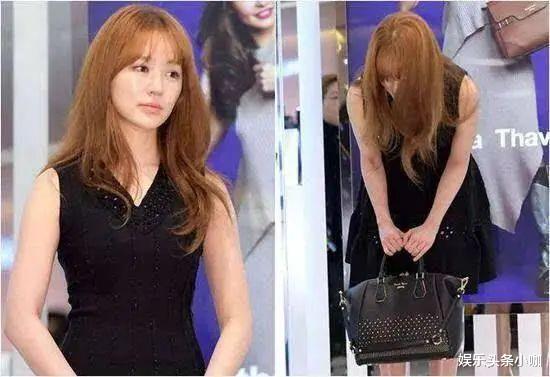 盘点那些整容失败的<a href=