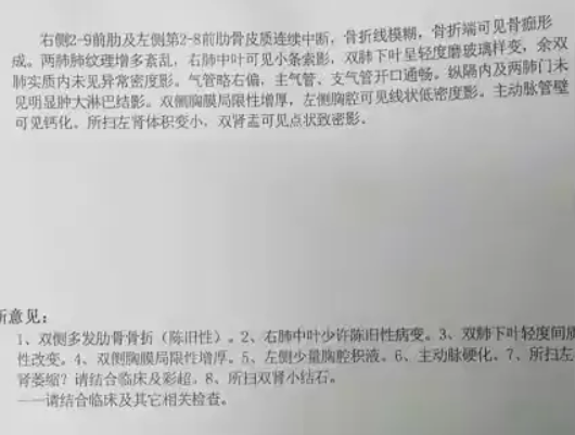 男子看守所关3个月断了15根肋骨,警方:确为所内受伤,正在调查休闲区蓝鸢梦想 - Www.slyday.coM 男子看守所关3个月断了15根肋骨,警方:确为所内受伤,正在调查休闲区蓝鸢梦想 - Www.slyday.coM