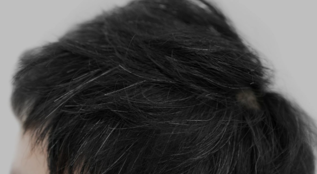 女性白头发日渐增多,先别以为自己老了,可能是缺乏3种营养休闲区蓝鸢梦想 - Www.slyday.coM 女性白头发日渐增多,先别以为自己老了,可能是缺乏3种营养休闲区蓝鸢梦想 - Www.slyday.coM